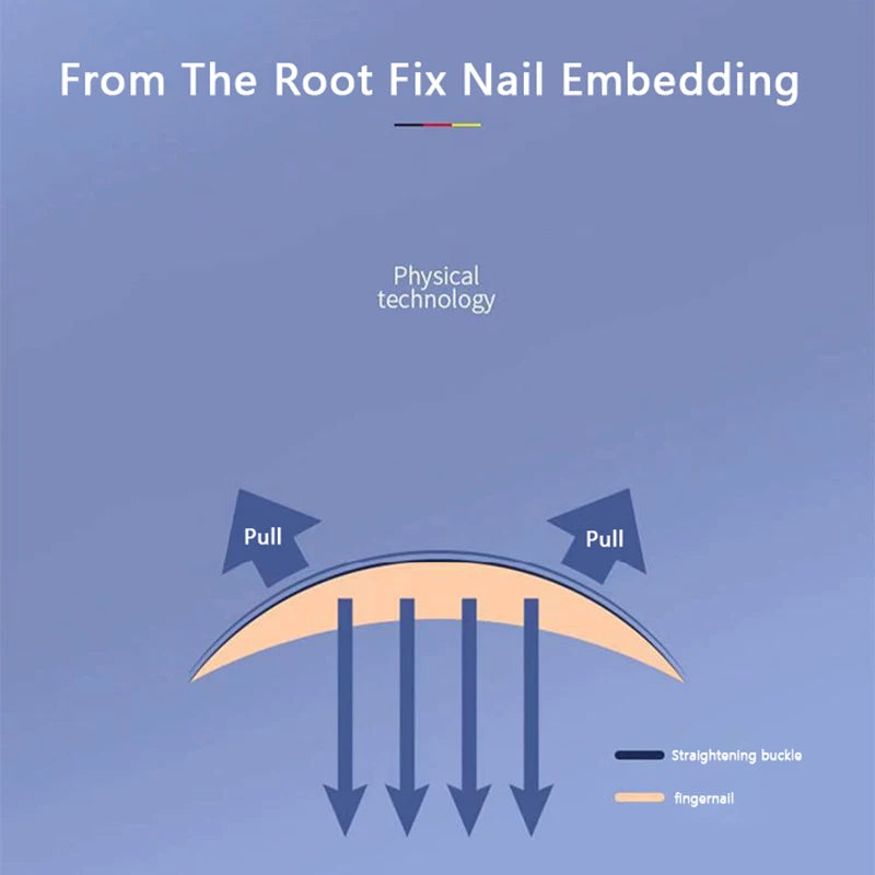 Ingrown Toenail Corrector Tools