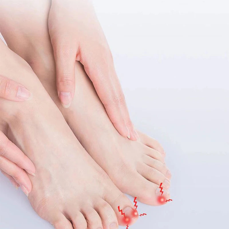 Ingrown Toenail Corrector Tools